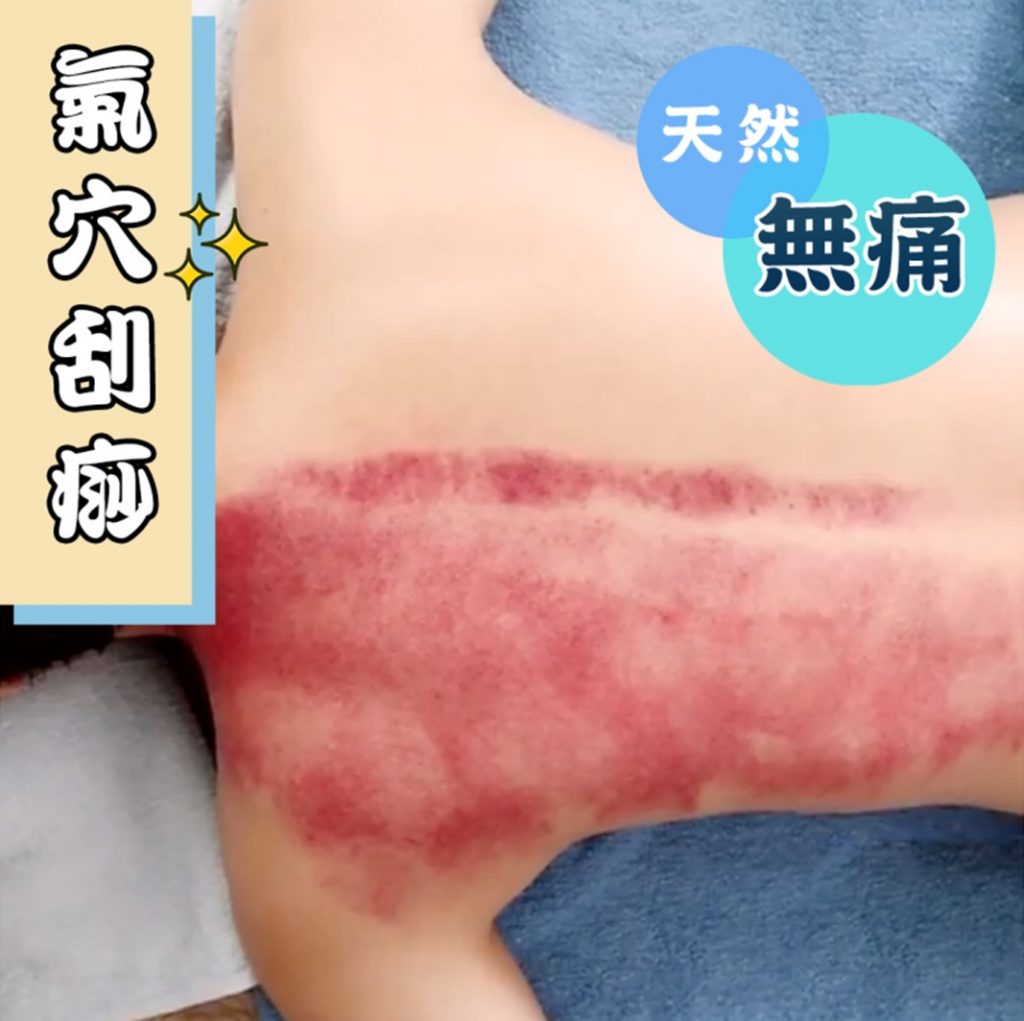 無痛刮痧快速排毒