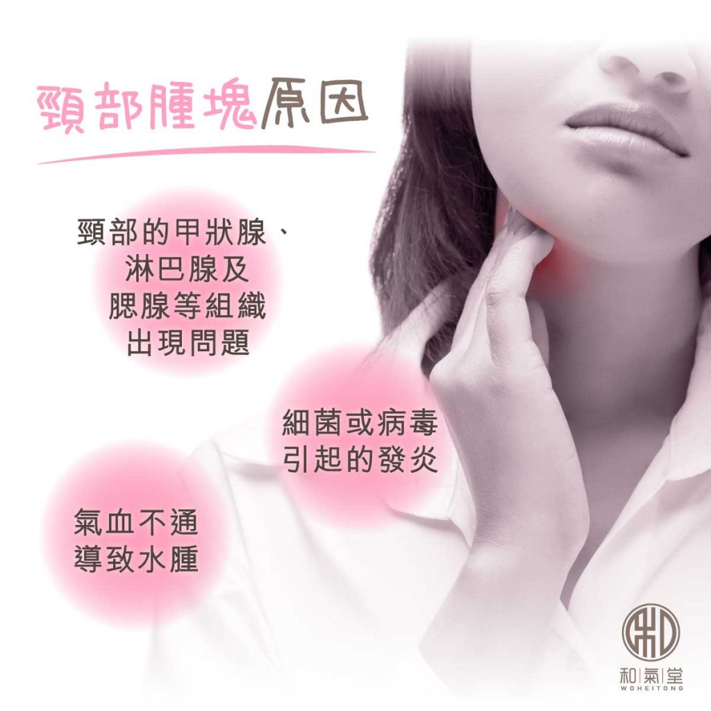 頸部腫脹原因