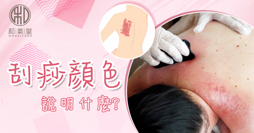 刮痧顏色
